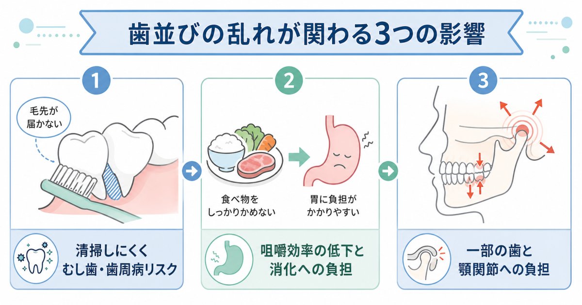 歯並びの乱れを放置することで生じる3つの健康リスク