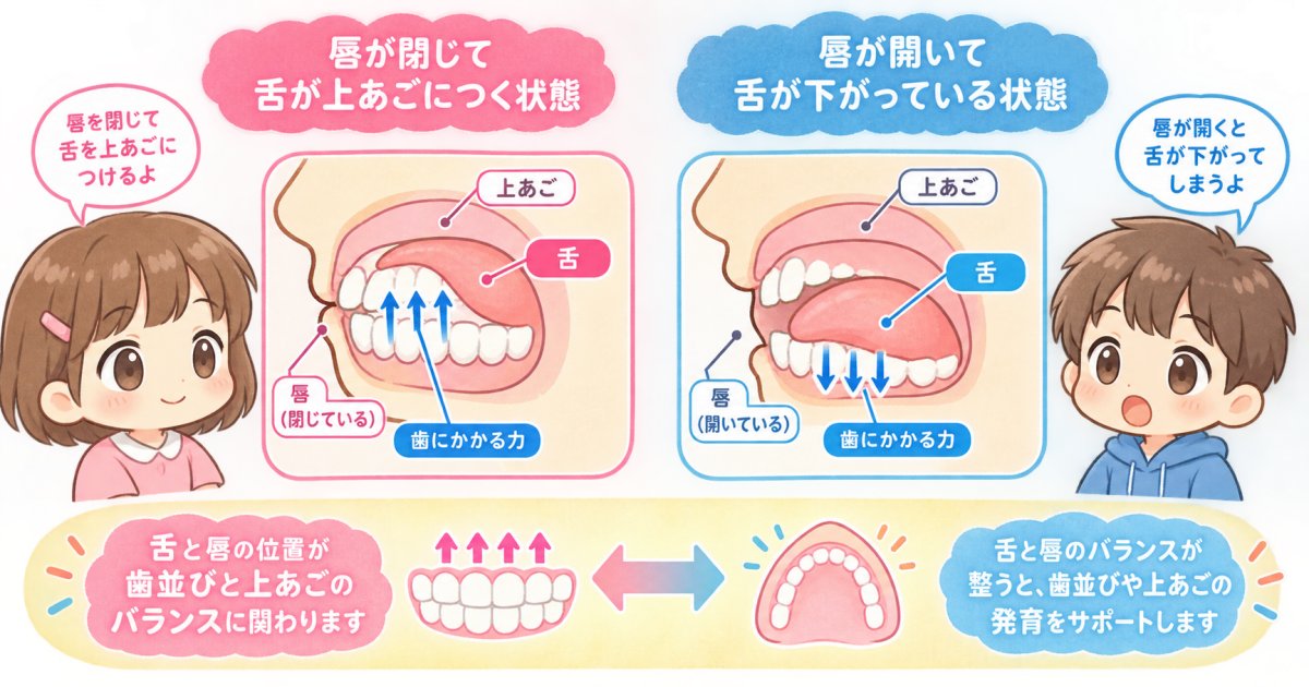 ぽかん口と口呼吸の違いと、舌・唇の位置が歯並びに悪影響を与え得るしくみ